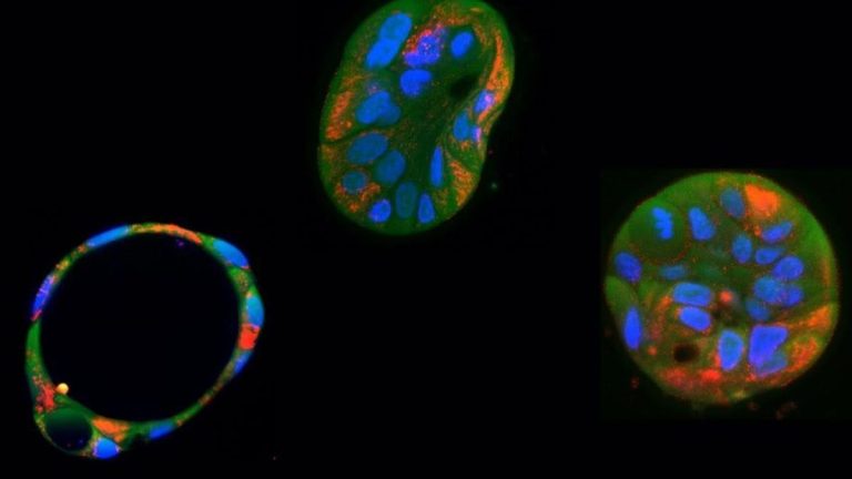 Editan y corrigen por primera vez el inaccesible ADN de las mitocondrias, que produce graves enfermedades raras